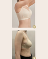 Floral Lace Wireless Bra